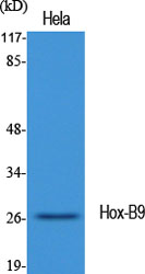Fig1:; Western Blot analysis of various cells using Hox-B9 Polyclonal Antibody diluted at 1: 1000 cells nucleus extracted by Minute TM Cytoplasmic and Nuclear Fractionation kit (SC-003,Inventbiotech,MN,USA).