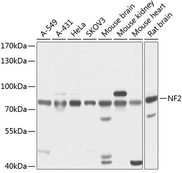 Western blot - NF2 Polyclonal Antibody 