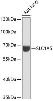 Western blot - SLC1A5 Polyclonal Antibody 