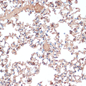 Immunohistochemistry - EMR1 Polyclonal Antibody 