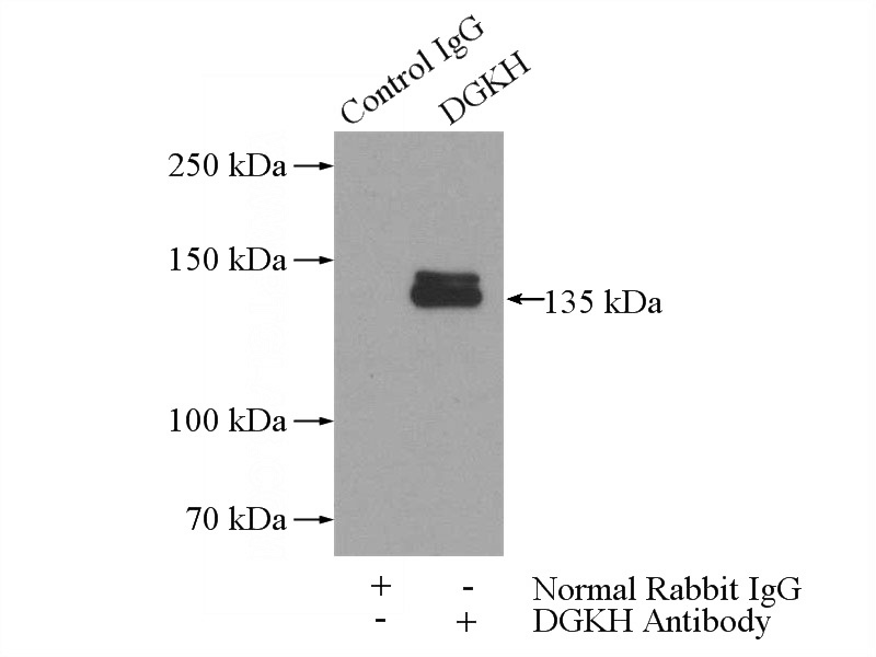 IP Result of anti-DGKH (IP:Catalog No:109912, 5ug; Detection:Catalog No:109912 1:500) with mouse brain tissue lysate 2640ug.