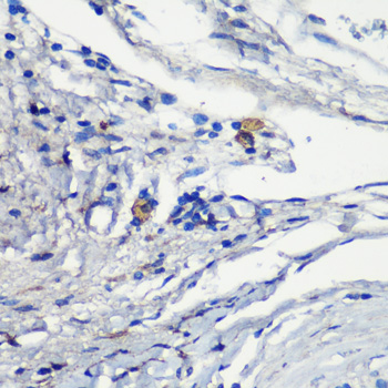 Immunohistochemistry - MRC1 Polyclonal Antibody 