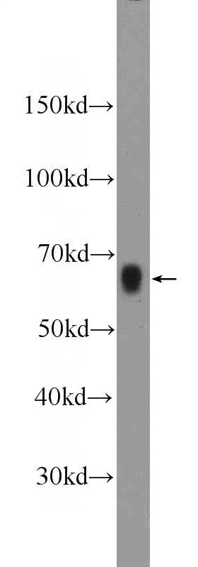 mouse colon tissue were subjected to SDS PAGE followed by western blot with Catalog No:108112(AOAH Antibody) at dilution of 1:600