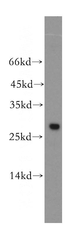 HL-60 cells were subjected to SDS PAGE followed by western blot with Catalog No:116536(UBE2S antibody) at dilution of 1:800