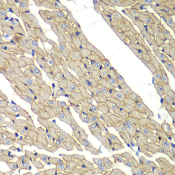 Immunohistochemistry - SGCD Polyclonal Antibody 