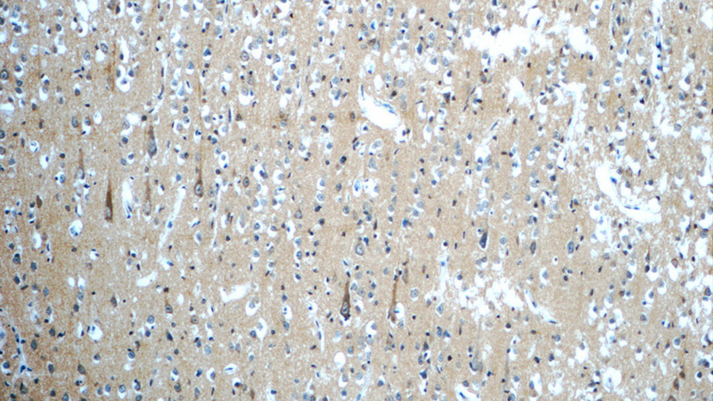 Immunohistochemistry of paraffin-embedded human brain slide using Catalog No:115506(SORL1 Antibody) at dilution of 1:50