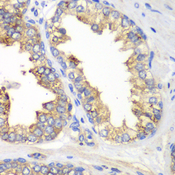 Immunohistochemistry - KLK10 Polyclonal Antibody 