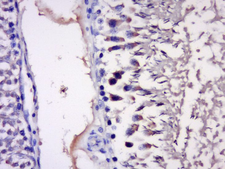 Fig4: Paraformaldehyde-fixed, paraffin embedded (Rat testis); Antigen retrieval by boiling in sodium citrate buffer (pH6.0) for 15min; Block endogenous peroxidase by 3% hydrogen peroxide for 20 minutes; Blocking buffer (normal goat serum) at 37℃ for 30min; Antibody incubation with (IMPACT) Polyclonal Antibody, Unconjugated at 1:400 overnight at 4℃, followed by operating according to SP Kit(Rabbit) (sp-0023) instructions and DAB staining.
