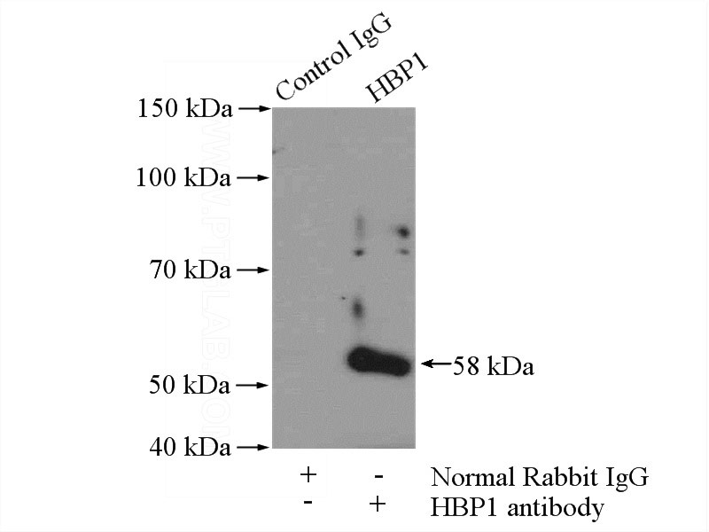 IP Result of anti-HBP1 (IP:Catalog No:111271, 4ug; Detection:Catalog No:111271 1:500) with mouse brain tissue lysate 4000ug.