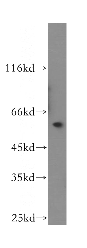 human liver tissue were subjected to SDS PAGE followed by western blot with Catalog No:115873(TBCE antibody) at dilution of 1:500