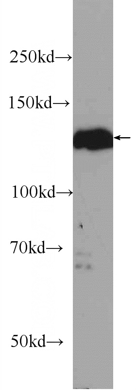SKOV-3 cells were subjected to SDS PAGE followed by western blot with Catalog No:115710(STK10 Antibody) at dilution of 1:600