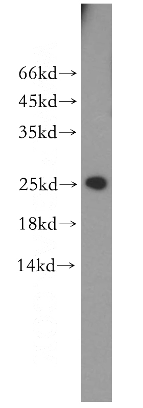 HeLa cells were subjected to SDS PAGE followed by western blot with Catalog No:112850(MRPS23 antibody) at dilution of 1:300