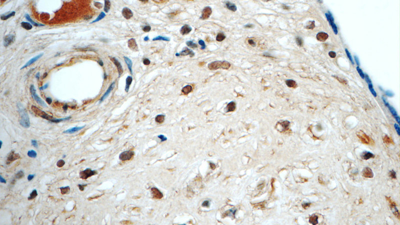 Immunohistochemistry of paraffin-embedded human placenta tissue slide using Catalog No:107409(LYN Antibody) at dilution of 1:50 (under 40x lens)