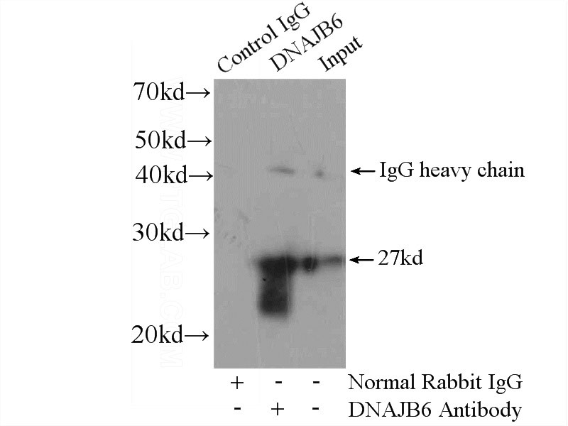 IP Result of anti-DNAJB6 (IP:Catalog No:110097, 4ug; Detection:Catalog No:110097 1:800) with mouse brain tissue lysate 4000ug.