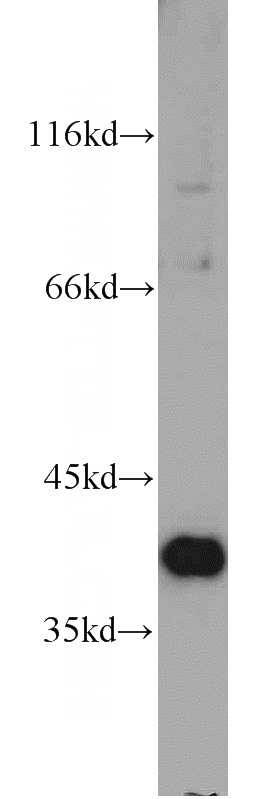 mouse thymus tissue were subjected to SDS PAGE followed by western blot with Catalog No:116105(TMEM173 antibody) at dilution of 1:500