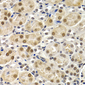 Immunohistochemistry - ID3 Polyclonal Antibody 