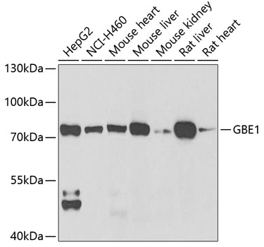 Western blot - GBE1 Polyclonal Antibody 