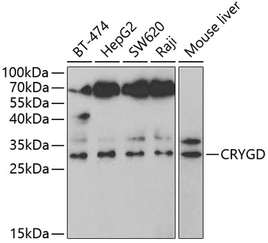 Western blot - CRYGD Polyclonal Antibody 