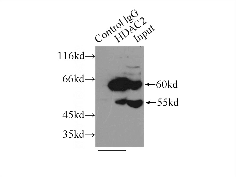 IP Result of anti-HDAC2 (IP:Catalog No:111373, 3ug; Detection:Catalog No:111373 1:1000) with mouse testis tissue lysate 10000ug.
