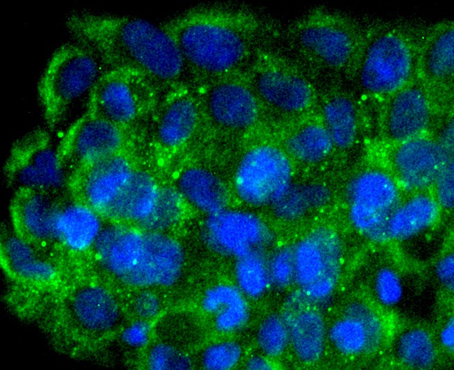 Fig2: ICC staining FNTB in JAR cells (green). The nuclear counter stain is DAPI (blue). Cells were fixed in paraformaldehyde, permeabilised with 0.25% Triton X100/PBS.