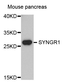 Western blot - SYNGR1 Polyclonal Antibody 