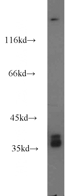 human brain tissue were subjected to SDS PAGE followed by western blot with Catalog No:110593(FAM50A antibody) at dilution of 1:1500