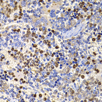 Immunohistochemistry - UBASH3B Polyclonal Antibody 