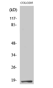 Fig1:; Western Blot analysis of various cells using TCEAL1 Polyclonal Antibody cells nucleus extracted by Minute TM Cytoplasmic and Nuclear Fractionation kit (SC-003,Inventbiotech,MN,USA).