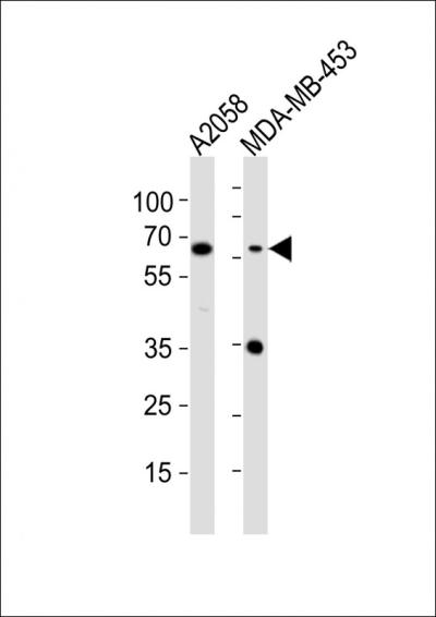 All lanes: Anti-CD63 Antibody (C-term) at 1:1000 dilutionnLane 1: A2058 whole cell lysatesnLane 2: MDA-MB-453 whole cell lysatesnnLysates/proteins at 20 u03bcg per lane. nnSecondarynGoat Anti-Rabbit IgG,  (H+L), Peroxidase conjugated at 1/10000 dilutionnnPredicted band size: 26 kDannBlocking/Dilution buffer: 5% NFDM/TBST.
