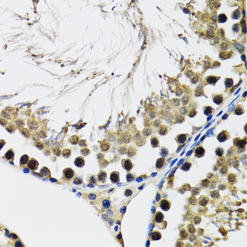 Immunohistochemistry - DDX41 Polyclonal Antibody 