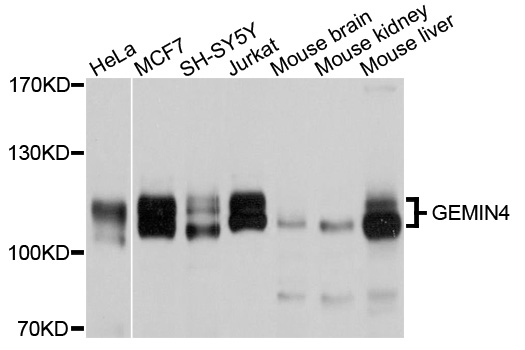 Western blot - GEMIN4 Polyclonal Antibody 