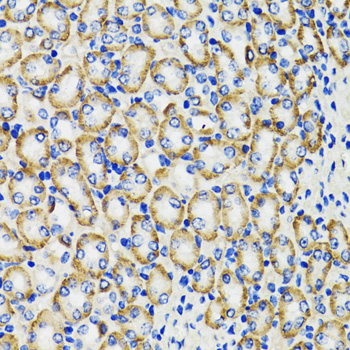 Immunohistochemistry - COMT Polyclonal Antibody 
