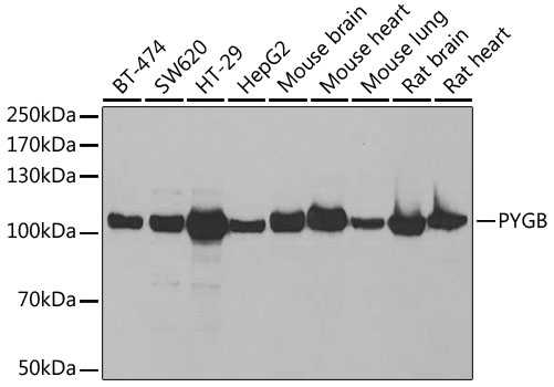 Western blot - PYGB Polyclonal Antibody 