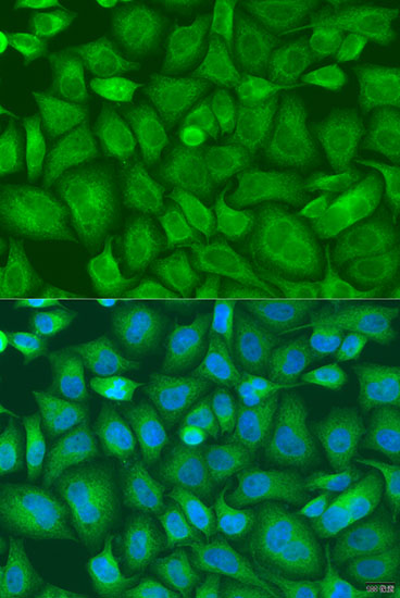Immunofluorescence - BAG2 Polyclonal Antibody 