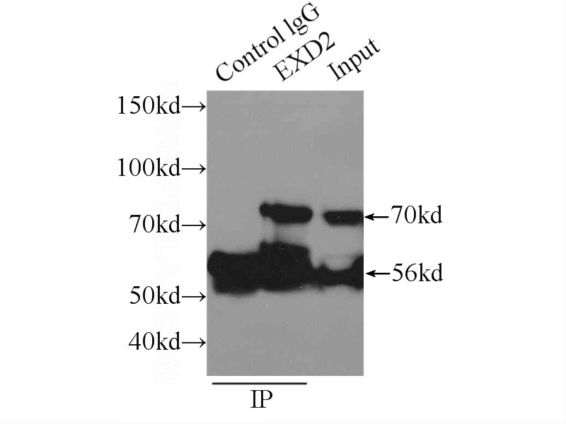 IP Result of anti-EXD2 (IP:Catalog No:110498, 3ug; Detection:Catalog No:110498 1:300) with mouse lung tissue lysate 5160ug.