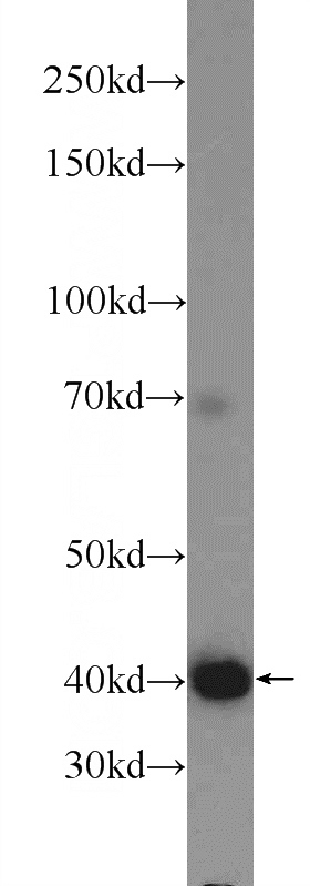 BxPC-3 cells were subjected to SDS PAGE followed by western blot with Catalog No:110654(FIBP Antibody) at dilution of 1:600
