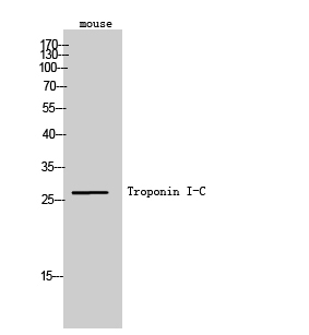 Fig1:; Western Blot analysis of mouse cells using Troponin I-C Polyclonal Antibody. Secondary antibody（catalog#: HA1001) was diluted at 1:20000