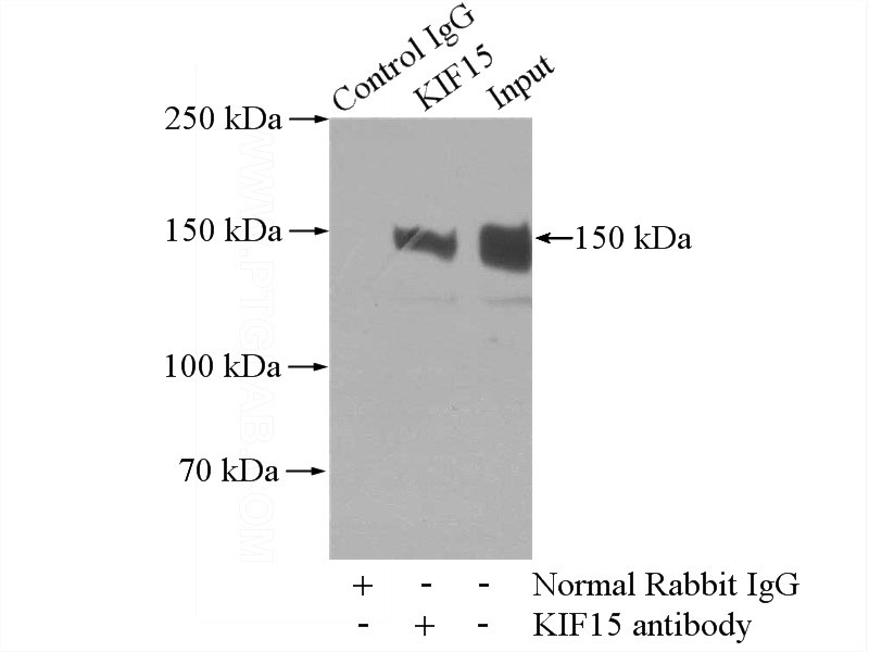 IP Result of anti-KIF15 (IP:Catalog No:112000, 4ug; Detection:Catalog No:112000 1:500) with mouse thymus tissue lysate 2800ug.