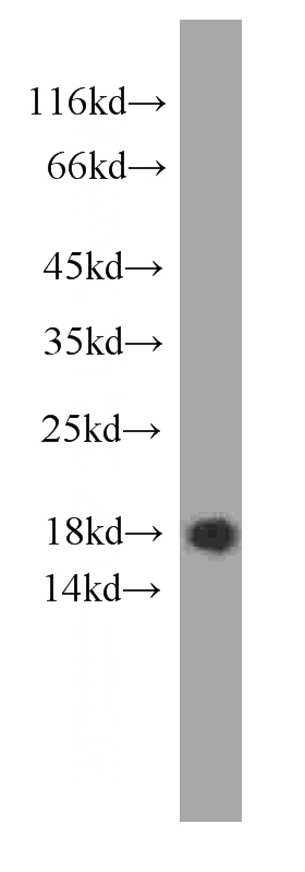 human heart tissue were subjected to SDS PAGE followed by western blot with Catalog No:107319(MYL2 antibody) at dilution of 1:1000