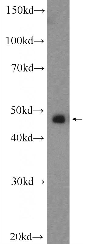 HeLa cells were subjected to SDS PAGE followed by western blot with Catalog No:117041(ZFP36L1 Antibody) at dilution of 1:300