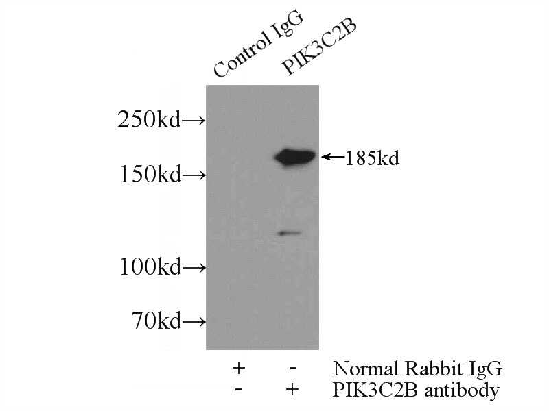 IP Result of anti-PIK3C2B (IP:Catalog No:113902, 5ug; Detection:Catalog No:113902 1:800) with HeLa cells lysate 2500ug.