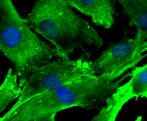 Fig3: ICC staining Nesprin 1 in C2C12 cells (green). The nuclear counter stain is DAPI (blue). Cells were fixed in paraformaldehyde, permeabilised with 0.25% Triton X100/PBS.