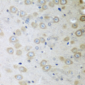 Immunohistochemistry - ATAD3A Polyclonal Antibody 