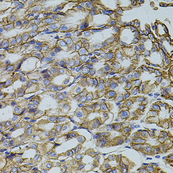Immunohistochemistry - TRMT2A Polyclonal Antibody 