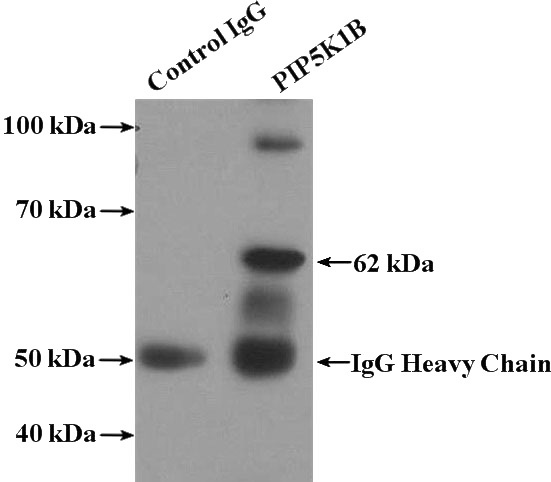 IP Result of anti-PIP5K1B (IP:Catalog No:113915, 4ug; Detection:Catalog No:113915 1:500) with mouse testis tissue lysate 4000ug.