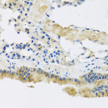 Immunohistochemistry - CLIP1 Polyclonal Antibody 