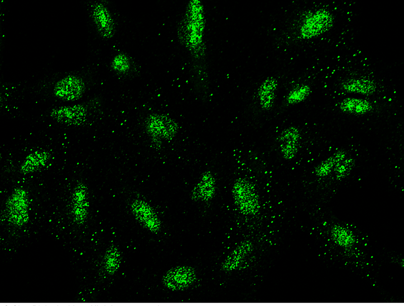 Human NUP107 Immunofluorescence(IF) 15572