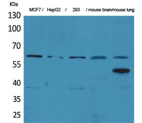 Fig1:; Western Blot analysis of MCF7, HepG2, 293, mouse brain, mouse lung cells using ZKSCAN4 Polyclonal Antibody.. Secondary antibody（catalog#: HA1001) was diluted at 1:20000 cells nucleus extracted by Minute TM Cytoplasmic and Nuclear Fractionation kit (SC-003,Inventbiotech,MN,USA).