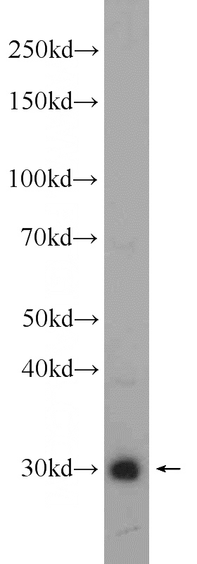 mouse brown adipose tissue were subjected to SDS PAGE followed by western blot with Catalog No:116545(UCP1 antibody) at dilution of 1:600