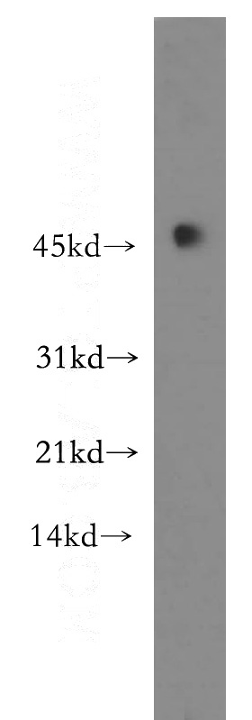 human spleen tissue were subjected to SDS PAGE followed by western blot with Catalog No:116769(VPREB3 antibody) at dilution of 1:400